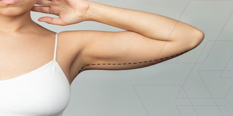 kol germe ameliyatı