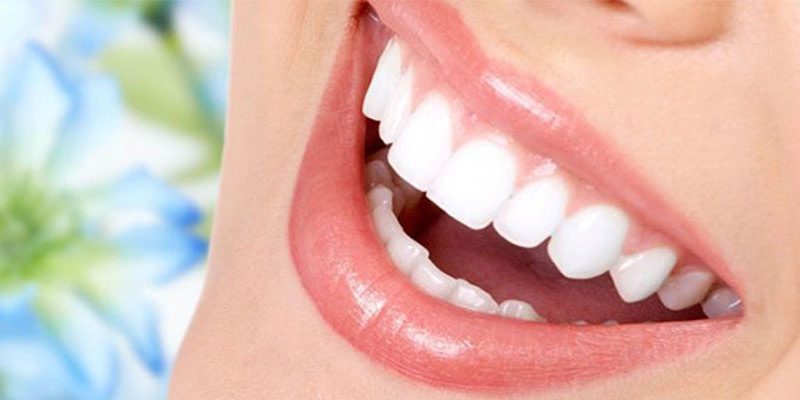 Porselen diş Kaplama