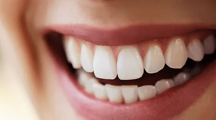 dental-aesthetics-in-turkey