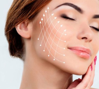 non-surgical-face-lift