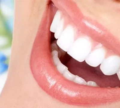 porcelain-veneer-in-turkey