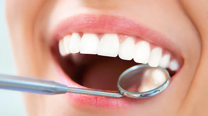 teeth-whitening-turkey
