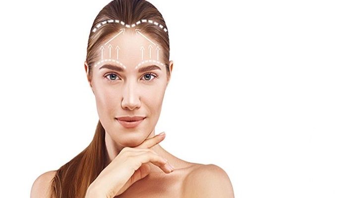 Forehead-Lift