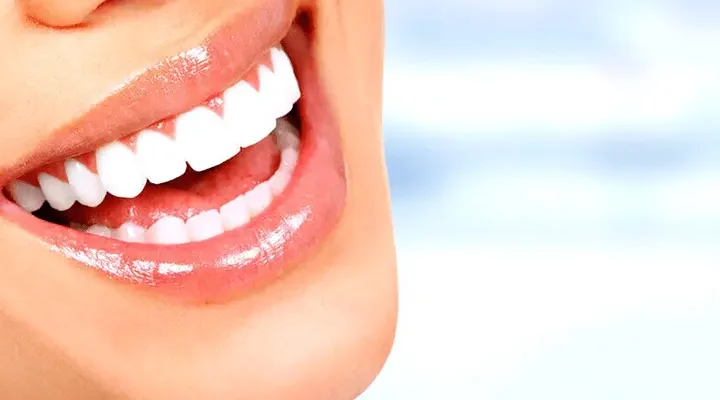 emax-veneer-in-turkey