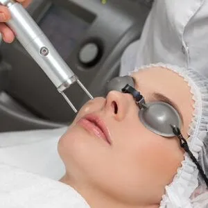 Q-Switch-Lazer-300x300