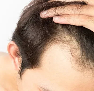 sac-koklerini-uyandirmak