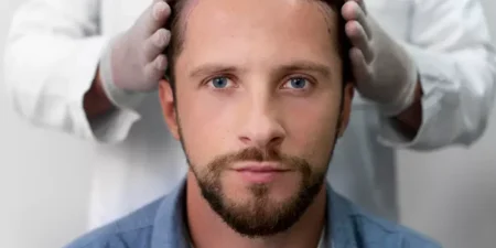 failed-hair-transplant-800x400