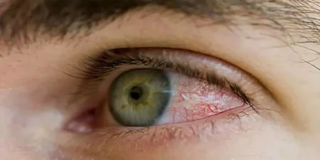 Diabetic Retinopathy Treatment