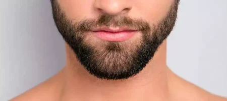 beard-transplant-turkey