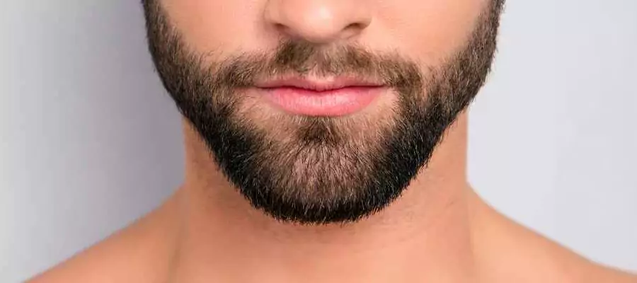 beard transplant turkey