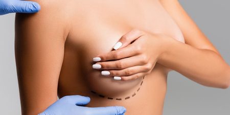 breast-reduction