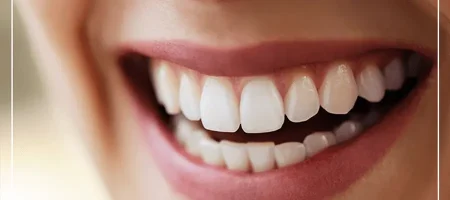 dental-aesthetics-in-turkey