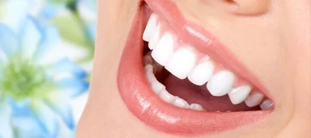 dental-veneer-in-turkey