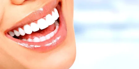 emax-veneer-in-turkey