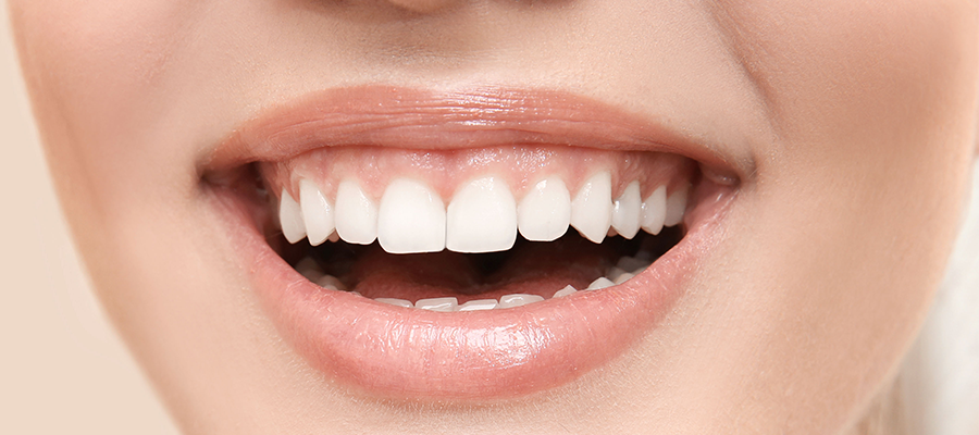 gummy smile in turkey