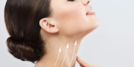 neck-lift-turkey