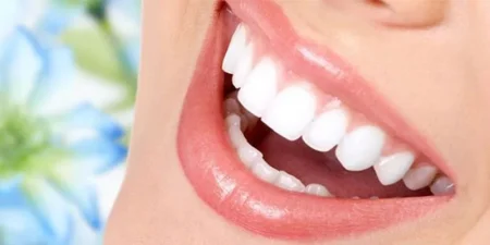 porcelain-veneer-in-turkey