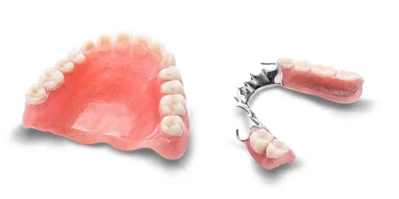 removable-denture-in-turkey