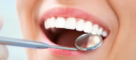 teeth-whitening-turkey
