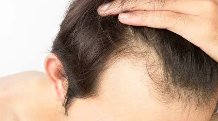 Uyuyan Saç Köklerini Uyandırmak