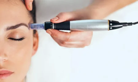 dermapen