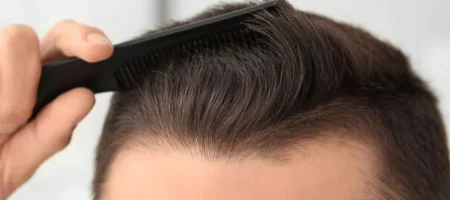 hair-surgery-istanbul