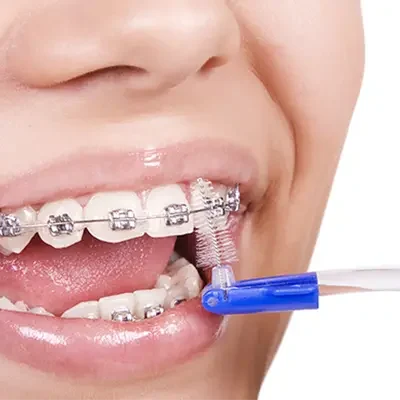 Orthodontics-in-turkey