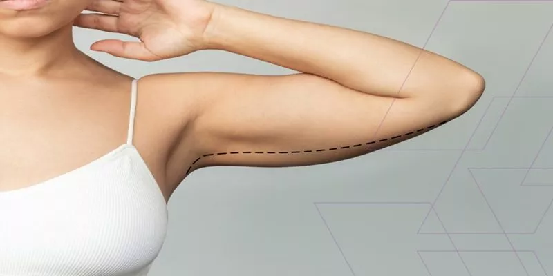 arm-lift-800x400-69a6d212965fe