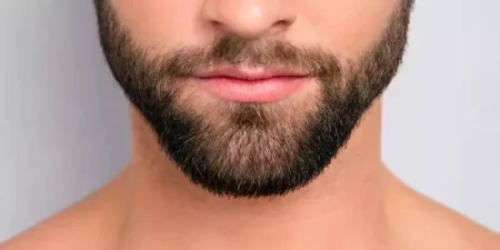 beard-transplant-turkey-800x400