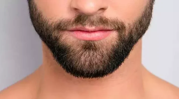 beard-transplant-turkey-800x400