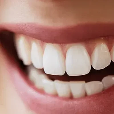 dental-aesthetics-in-turkey-800x400