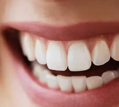 dental-aesthetics-in-turkey-800x400