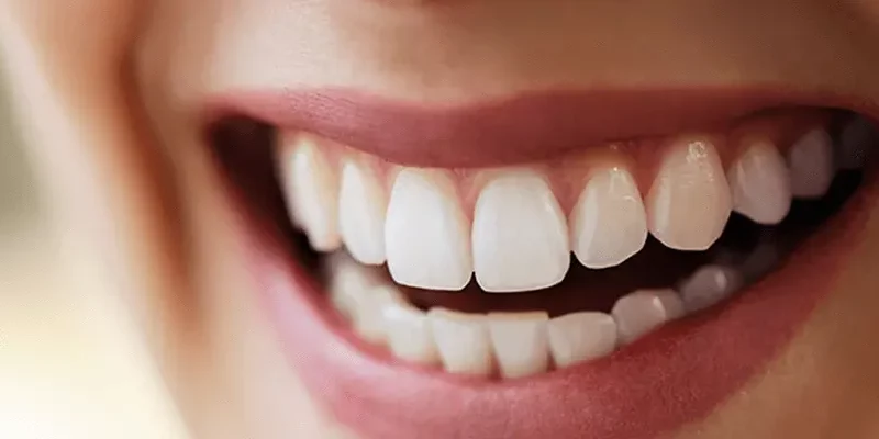 dental-aesthetics-in-turkey-800x400