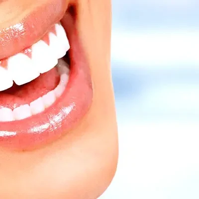 emax-veneer-in-turkey