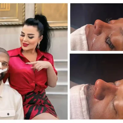 ethnic rhinoplasty in turkey