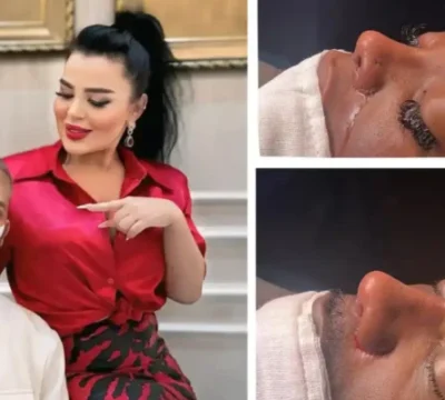 ethnic-rhinoplasty-in-turkey-800x400