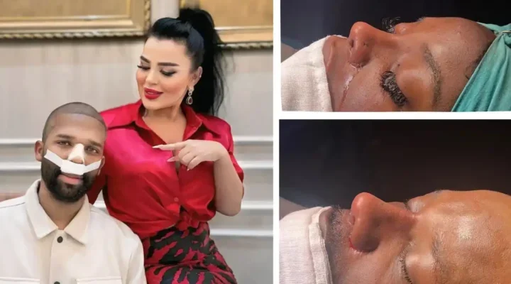 ethnic-rhinoplasty-in-turkey-800x400