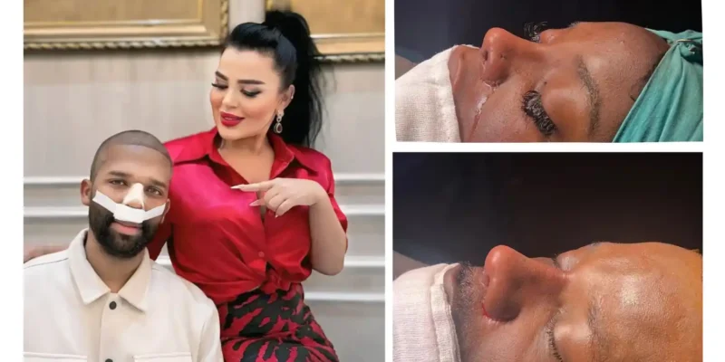 ethnic-rhinoplasty-in-turkey-800x400