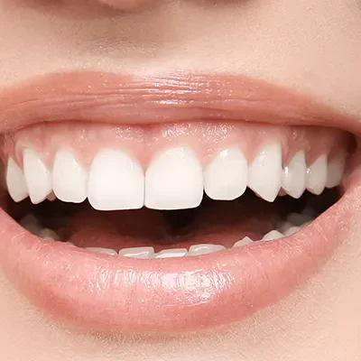 gummysmile-800x400-69a6ce2e46050