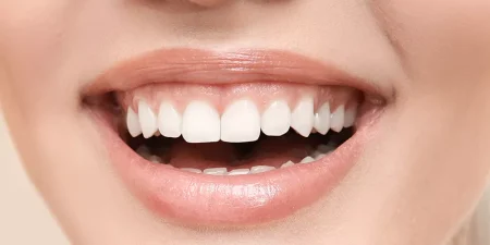 gummysmile-800x400-69a6ce2e46050