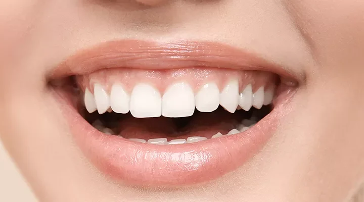 gummysmile-800x400-69a6ce2e46050