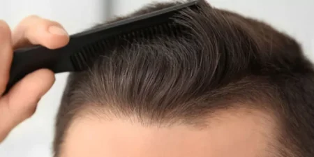 hair-surgery-istanbul-800x400