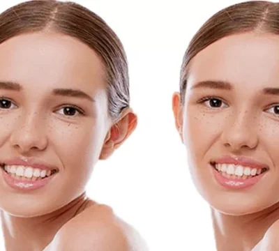 otoplasty-800x400-69a6d0b1e04cc