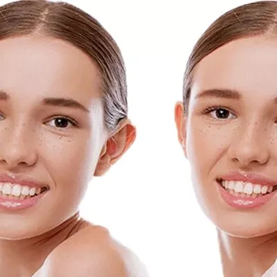 otoplasty-800x400-69a6d0b1e04cc