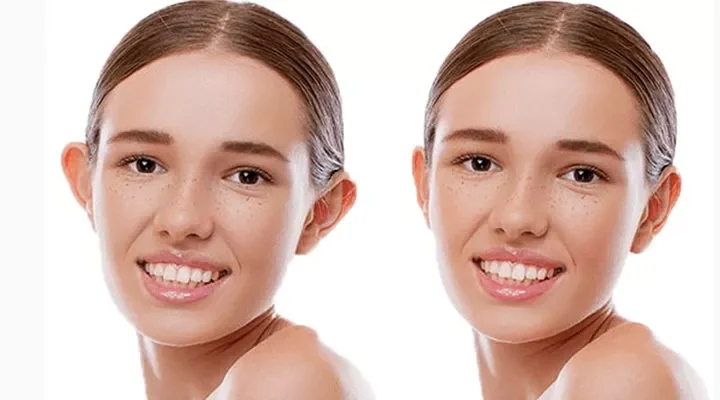 otoplasty-800x400-69a6d0b1e04cc