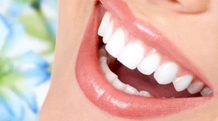 porcelain-veneer-in-turkey