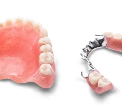 removable-denture-in-turkey