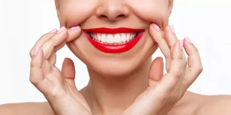 smile-design-turkey-800x400