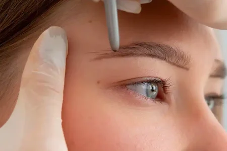 Bella Brow Eyebrow Transplant