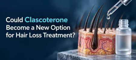 could-clascoterone-become-a-new-option-for-hair-loss-treatment